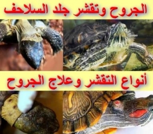 الجروح وتقشر جلد السلاحف: بين الطبيعي والمَرَضي